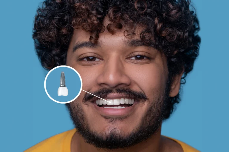 Man with toothy smile demonstrating his dental implant.